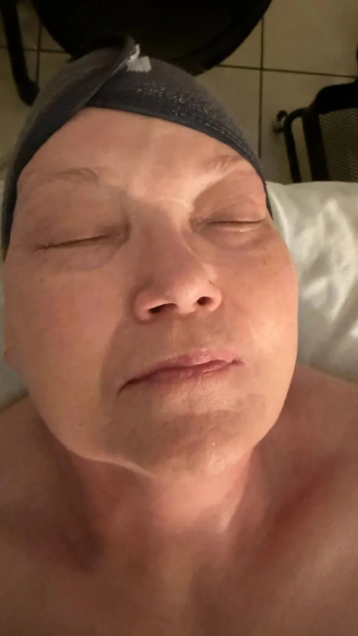 Procedure Photo 5
